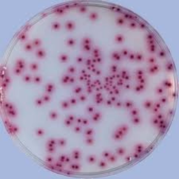 Recuento de bacterias     